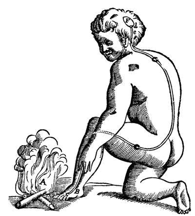 Descartes model of pain perception 24 . The Cartesian perspective dominated the understanding of pain until 1965 when the Gate Control Theory of pain was proposed by Melzack and Wall 18 . They described a gate control system at spinal level modulating sensory stimulation before pain is perceived and responded to. The model proposed that thin diameter (transmitting pain sensations) and large diameter (transmitting touch, pressure, vibration sensations) nerve fibers carry sensory information from the site of injury to two destinations in the dorsal horn of
