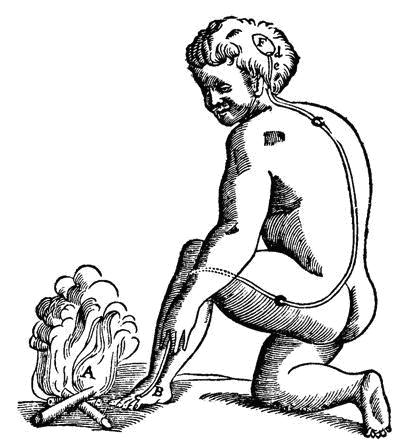 Descartes model of pain perception 24 . The Cartesian perspective dominated the understanding of pain until 1965 when the Gate Control Theory of pain was proposed by Melzack and Wall 18 . They described a gate control system at spinal level modulating sensory stimulation before pain is perceived and responded to. The model proposed that thin diameter (transmitting pain sensations) and large diameter (transmitting touch, pressure, vibration sensations) nerve fibers carry sensory information from the site of injury to two destinations in the dorsal horn of  